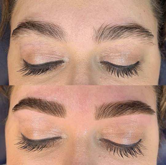 Brows